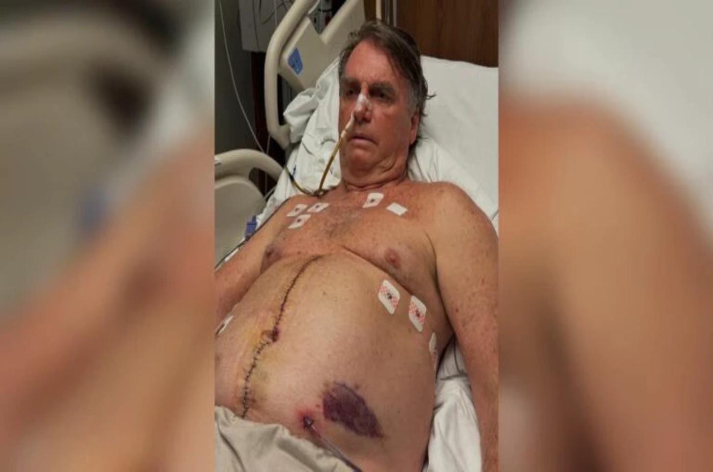 Na Páscoa, Bolsonaro agradece apoio e atualiza estado de saúde